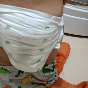 Baby Turco Ürün Kalitesizliği
