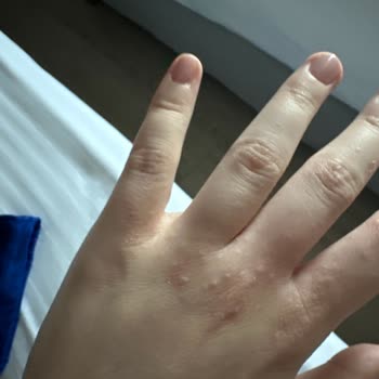 Rawda Resort Hotel Tarihi Geçmiş Ürünler Ve Yanlış Oda Problemi