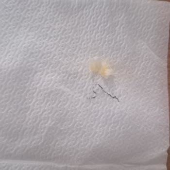 Kumpir Sarayı (Ortaköy) Yiyecekten Bulaşık Teli Çıktı