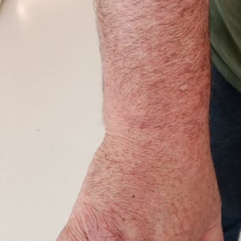 Göztepe Prof. Dr. Süleyman Yalçın Şehir Hastanesi Hasta Hakları Doktor İhmalkarlığı
