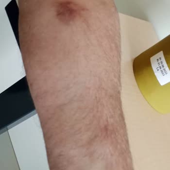 Göztepe Prof. Dr. Süleyman Yalçın Şehir Hastanesi Hasta Hakları Doktor İhmalkarlığı