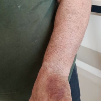 Göztepe Prof. Dr. Süleyman Yalçın Şehir Hastanesi Hasta Hakları Doktor İhmalkarlığı