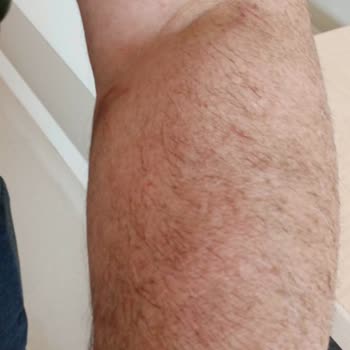 Göztepe Prof. Dr. Süleyman Yalçın Şehir Hastanesi Hasta Hakları Doktor İhmalkarlığı