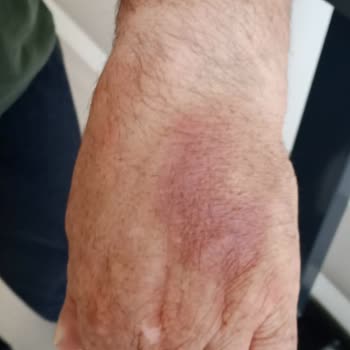 Göztepe Prof. Dr. Süleyman Yalçın Şehir Hastanesi Hasta Hakları Doktor İhmalkarlığı