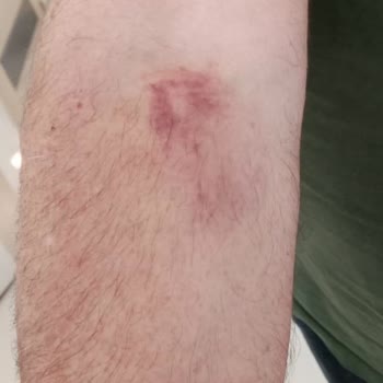 Göztepe Prof. Dr. Süleyman Yalçın Şehir Hastanesi Hasta Hakları Doktor İhmalkarlığı