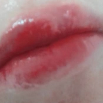 Assya Güzellik Merkezi Dudak Renklendirme İşlemi