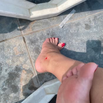 Çukurova Park Vadi Tesisleri Hizmet Yetersizliği Ve Tesisle İlgili Vaatlerin Yalan Olması