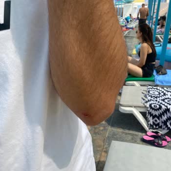 Çukurova Park Vadi Tesisleri Çukurova Park Vadi Mülteci Ve Hijyen Skandalı