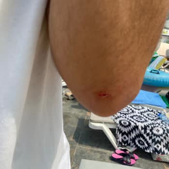 Çukurova Park Vadi Tesisleri Çukurova Park Vadi Mülteci Ve Hijyen Skandalı