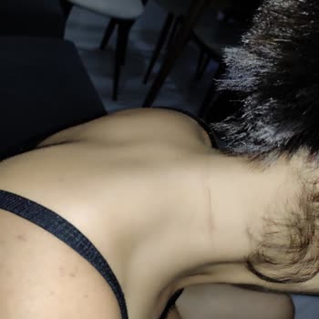 Nis Kuaför Saç Kesiminde Cildim Hasar Gördü