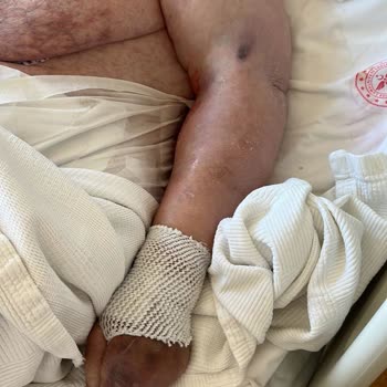 Çam Sakura Hastanesi Annemin Ölümünü İzledi