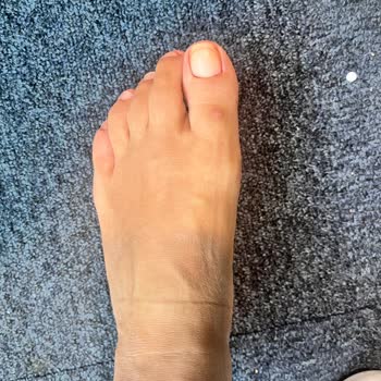 Desa Deri Parmak Arası Terlik Yara Yaptı