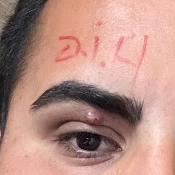 Dünya Göz Hastanesi Hastane Sorumsuzluğu Ve İlgisizliği