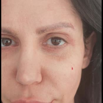 Alanya EsteGÖZ Klinik Şikayet