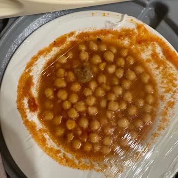 Özel Ortadoğu Hastanesi (Mersin) Ameliyat Sonrası Vip Servis Deneyimimiz