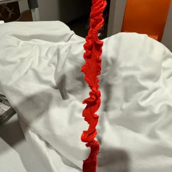 Özel Ortadoğu Hastanesi (Mersin) Ameliyat Sonrası Vip Servis Deneyimimiz