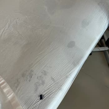 Özel Ortadoğu Hastanesi (Mersin) Ameliyat Sonrası Vip Servis Deneyimimiz