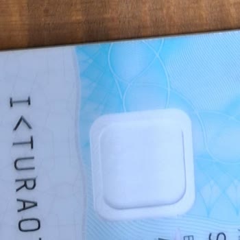 Nüfus ve Vatandaşlık İşleri Kimlik Kartı Çip Düşmesi