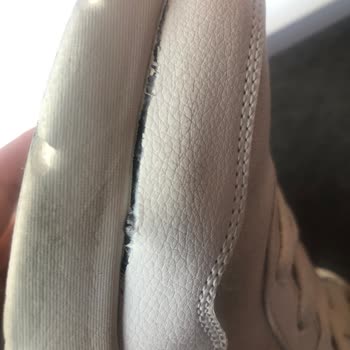 Skechers Türkiye Yardımcı Olmuyor