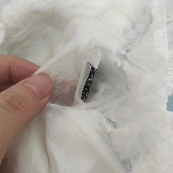 Sleepy Bebek Bezi İçinde Bilinmeyen Cisim