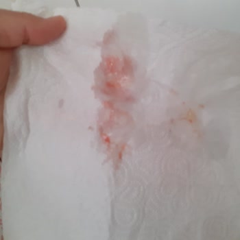 Turunç Resort Otel İle Facia Anımız