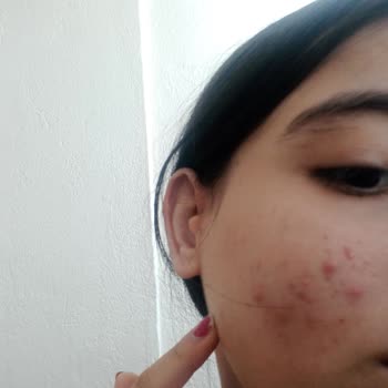 Garnier C Vitamini Yüz Temizleme Jeli