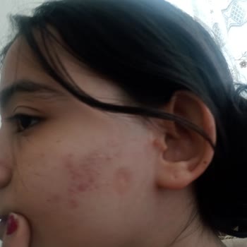 Garnier C Vitamini Yüz Temizleme Jeli