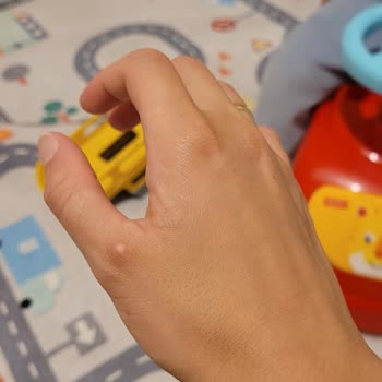 Dyson V8 Parmağımı Yara Yaptı.