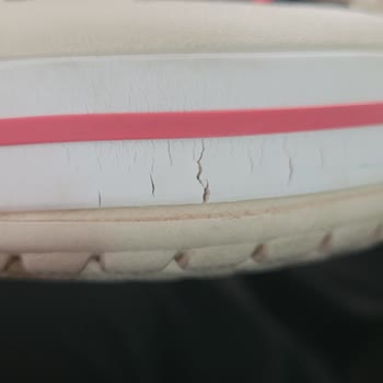 Migros Crocs Çatlaması Ve Ürün Orijinalliği