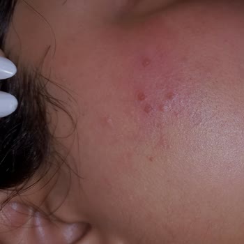 Sesu Tüy Sarartıcı Kötü