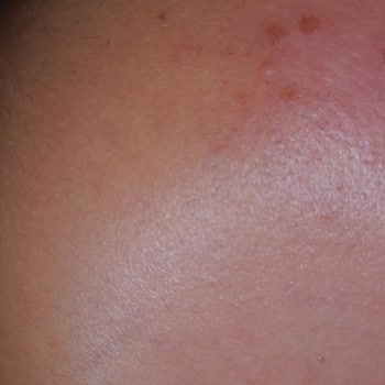 Sesu Tüy Sarartıcı Kötü