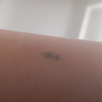 Yasemin Babadağ Kalıcı Makyaj Kursu Uygulama Sonrası Kolumda Kalan İz