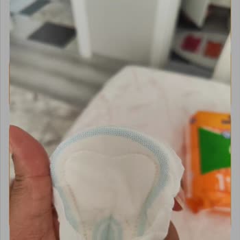 Orkid Pedlerin Kenar Koruması Yok