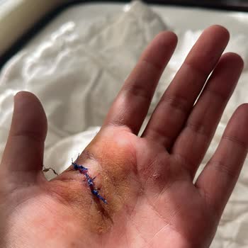 Alanya Alaaddin Keykubat Üniversitesi Eğitim Ve Araştırma Hastanesi Artık Acilde Ücret Ödenecek