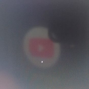 Philips TV Ölü Piksel Ve Servis Sorunu