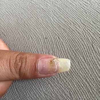 Cansay Nail Beauty Tırnağımda Mantar Oluşturdular