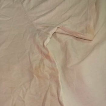 Yumoş Deterjanı Mağduru Beyazlarım Artık Sarı Lekeli Ve Delik Deşik😡