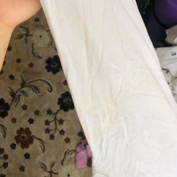 Yumoş Deterjanı Mağduru Beyazlarım Artık Sarı Lekeli Ve Delik Deşik😡