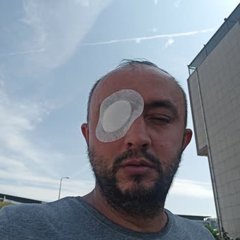 SGK EYLEA İğnesi İçin Devlet Desteği