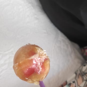 A101 Lolipopun İçinden Kan Çıktı