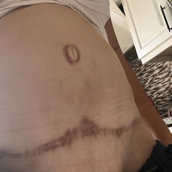 Doktor Onurkan İdacı Ve Estetik Operasyonlar