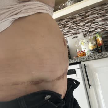 Doktor Onurkan İdacı Ve Estetik Operasyonlar