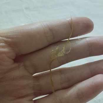 Öncü Dönerin İçinden Tuhaf Bir Şey Çıktı