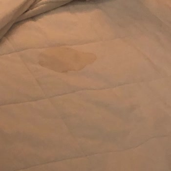 Anemon Hotels Kabus Gibi Bir Otel