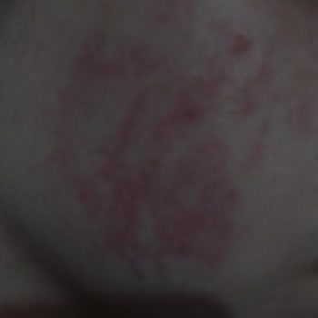 Wiwify Nemlendirici Cildimi Mahvetti