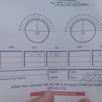 Özel Sondurak Ümran Tıp Merkezi İlgisiz Doktorun Yanlış Lens Reçetesi Yazması