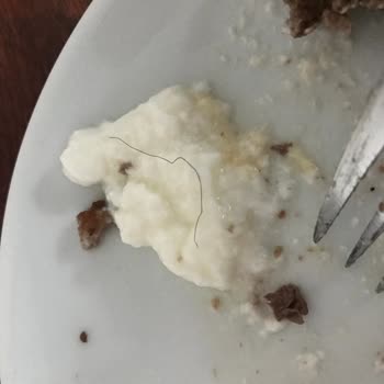 Royal Hastanesi Hastane Tedavi Ve Hijyen Sorunu