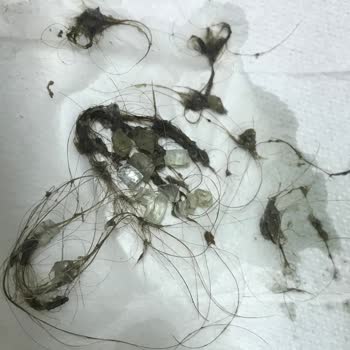 Royal Hastanesi Hastane Tedavi Ve Hijyen Sorunu