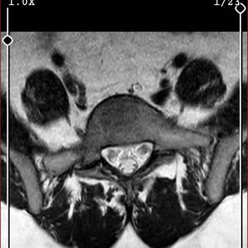 MACFit (İstanbul Avrupa) Kale Center Şubesinden Aldığım Üyelik Hakkında Şikayetim