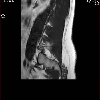 MACFit (İstanbul Avrupa) Kale Center Şubesinden Aldığım Üyelik Hakkında Şikayetim
